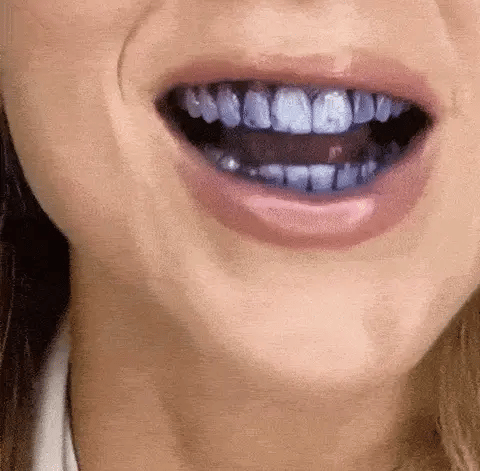 Hismile v34 Color Corrector Serum - Instant Teeth Whitening